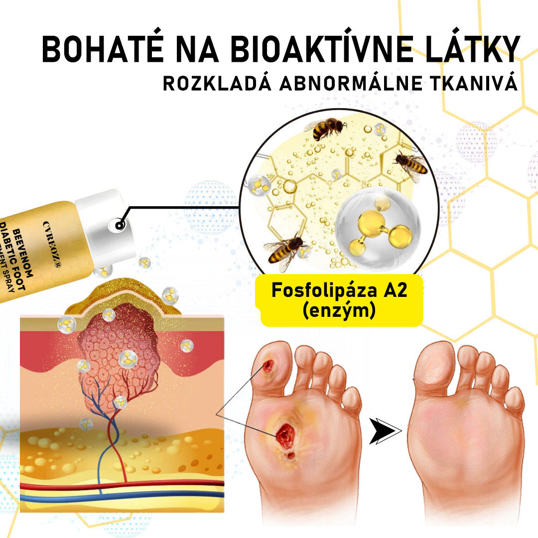 CVREOZ® Bee Venom Sprej na liečbu diabetickej nohy 🔥 Akcia na obmedzený čas – 60 % zľava 🔥🔥