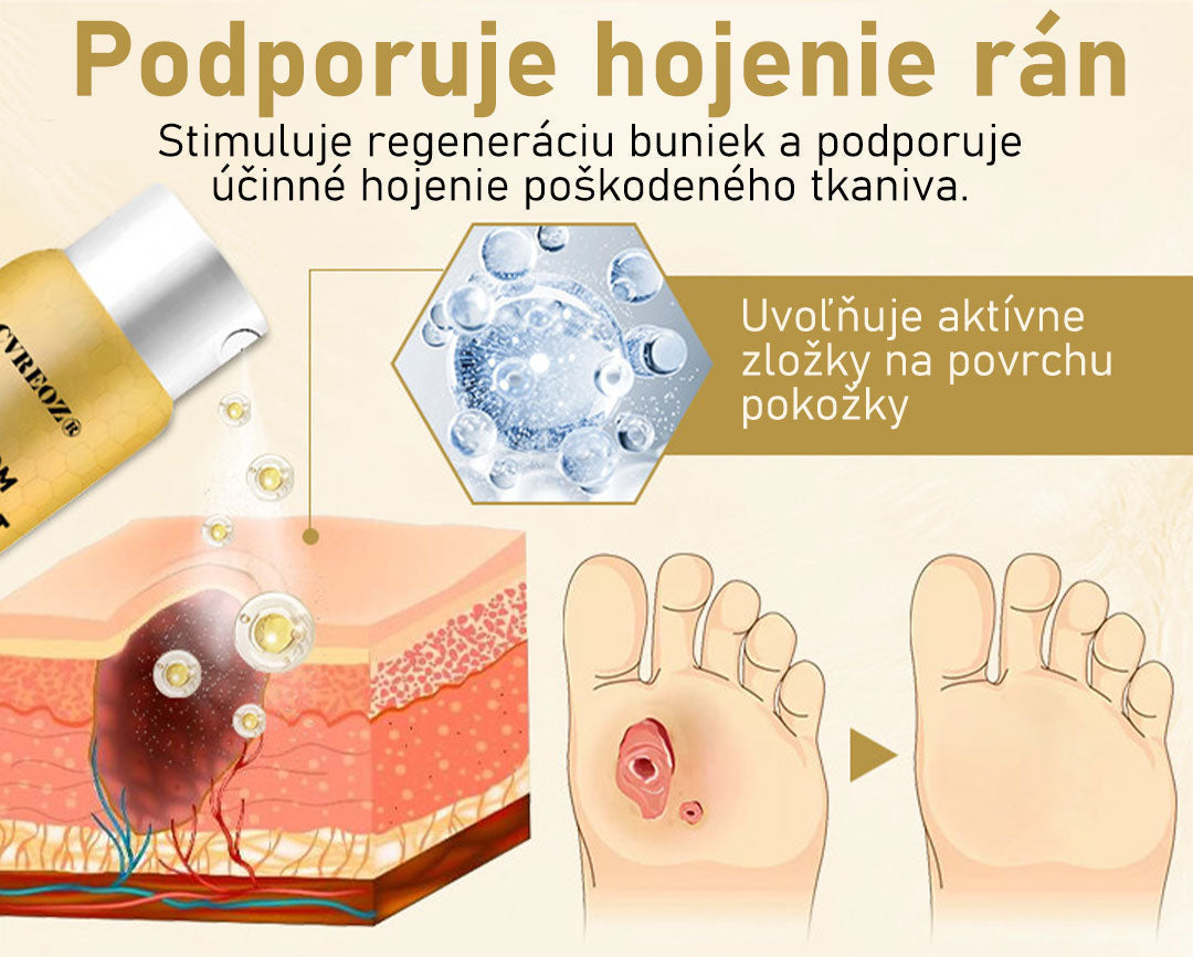 CVREOZ® Bee Venom Sprej na liečbu diabetickej nohy 🔥 Akcia na obmedzený čas – 60 % zľava 🔥🔥