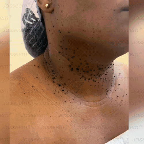 𝐉𝐚𝐬𝐬𝐞𝐞𝐦® Pokročilé neinvazívne CO₂ laserové pero na opravu pokožky 💕 (Jemne odstraňuje bradavice, materské znamienka, starecké škvrny a kožné výrastky – bez bolesti, bez starostí!) 💕