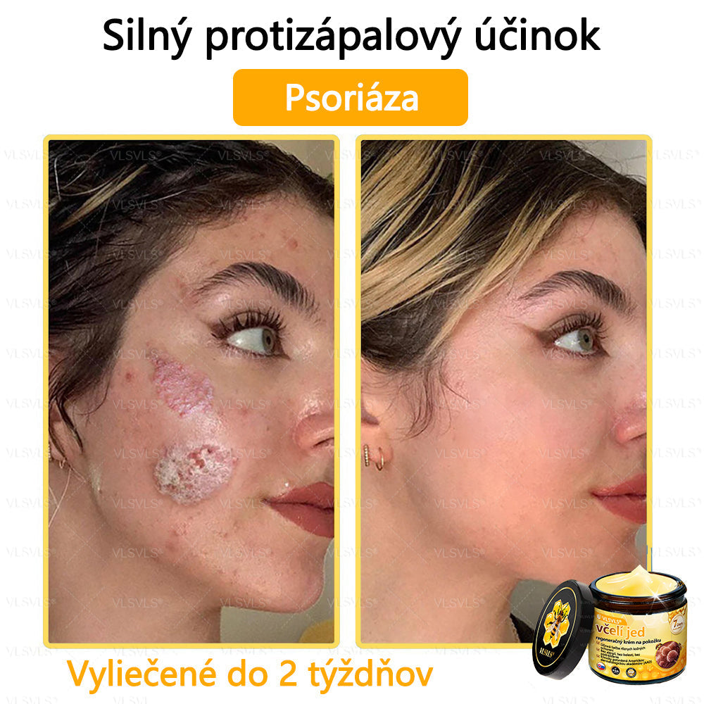 VLSVLS™ Obnovujúci krém na pleť so včelím jedom💥