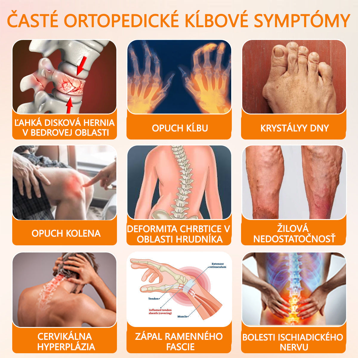 🦴ADNOON® Krém na hojenie kostí s botulotoxínom a včelím jedom ⭐👨⚕️Schválené Slovenskou spoločnosťou ortopedie a traumatológie (SOTS)🦴