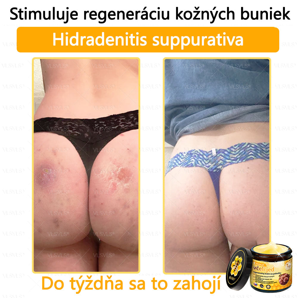 VLSVLS™ Obnovujúci krém na pleť so včelím jedom💥