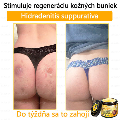VLSVLS™ Obnovujúci krém na pleť so včelím jedom💥