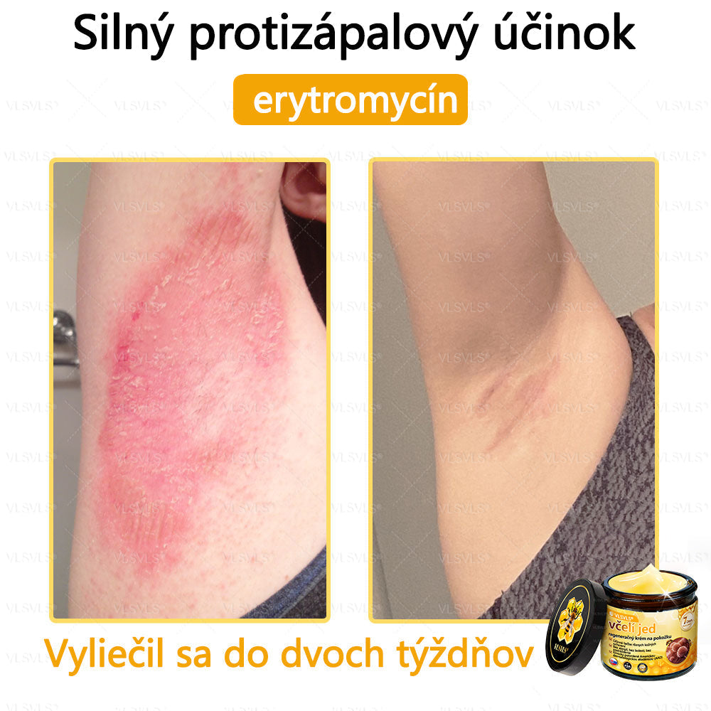 VLSVLS™ Obnovujúci krém na pleť so včelím jedom💥