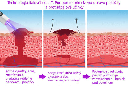 𝐉𝐚𝐬𝐬𝐞𝐞𝐦® Pokročilé neinvazívne CO₂ laserové pero na opravu pokožky 💕 (Jemne odstraňuje bradavice, materské znamienka, starecké škvrny a kožné výrastky – bez bolesti, bez starostí!) 💕