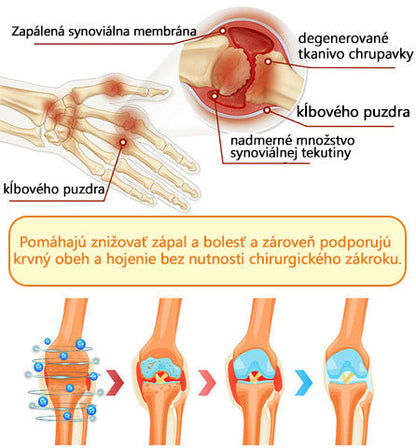 🦴ADNOON® Krém na hojenie kostí s botulotoxínom a včelím jedom ⭐👨‍⚕️Schválené Slovenskou spoločnosťou ortopedie a traumatológie (SOTS)🦴