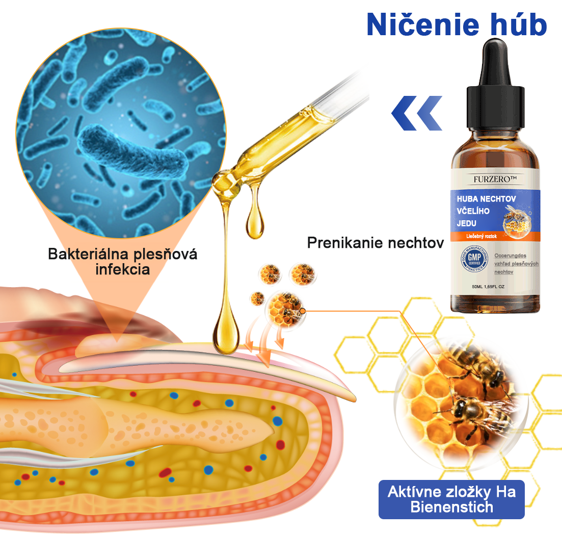 🐝Furzero™ Včelí jed na plesne na nechtoch: kompletné riešenie plesní na nechtoch 🌟👣👣