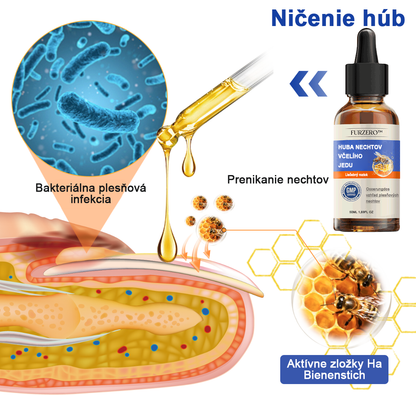 🐝Furzero™ Včelí jed na plesne na nechtoch: kompletné riešenie plesní na nechtoch 🌟👣👣