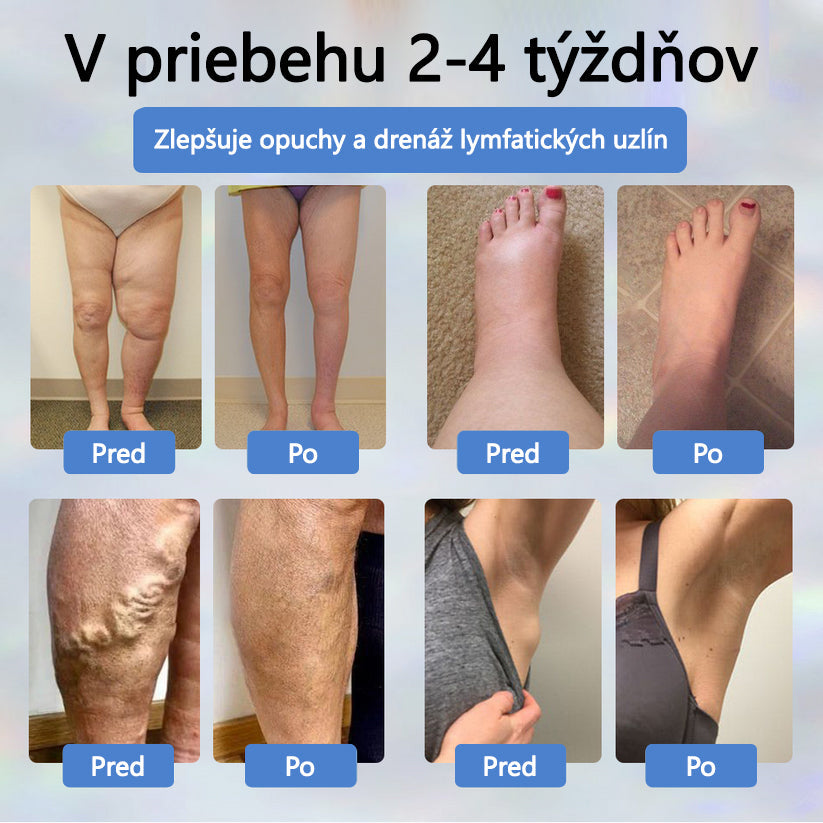 💧💧ATTDX® Bylinný krém na úľavu od opuchov s čiernou rascou💧💧💧💧