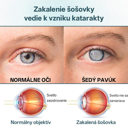 💧👁️Očné kvapky Timilk® OptiFusion Nano sérum！💧💧💧