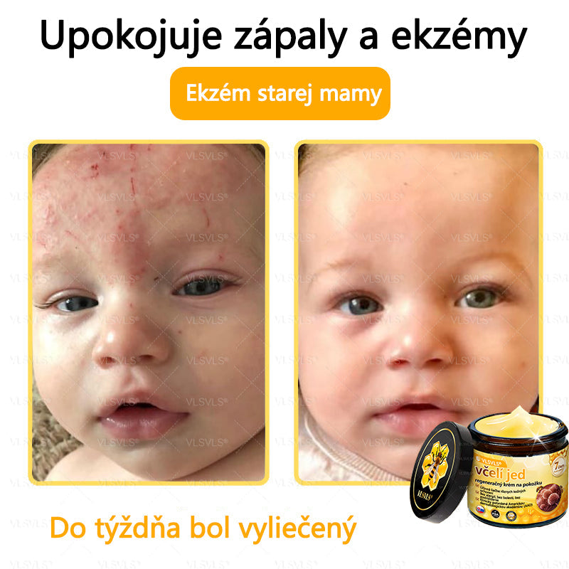 VLSVLS™ Obnovujúci krém na pleť so včelím jedom💥