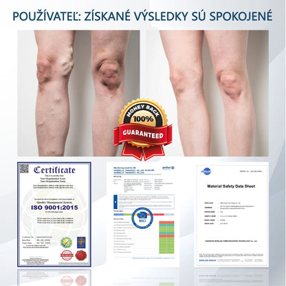 💧💧ATTDX® Bylinný krém na úľavu od opuchov s čiernou rascou💧💧💧💧