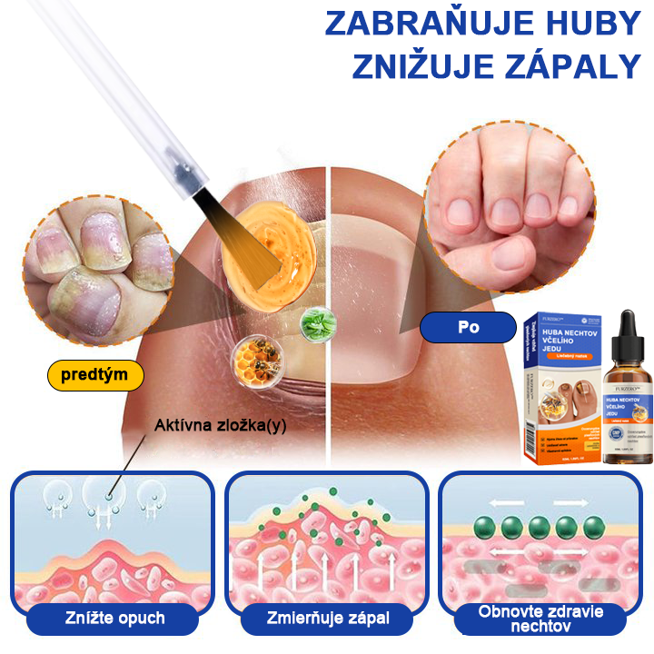 🐝Furzero™ Včelí jed na plesne na nechtoch: kompletné riešenie plesní na nechtoch 🌟👣👣