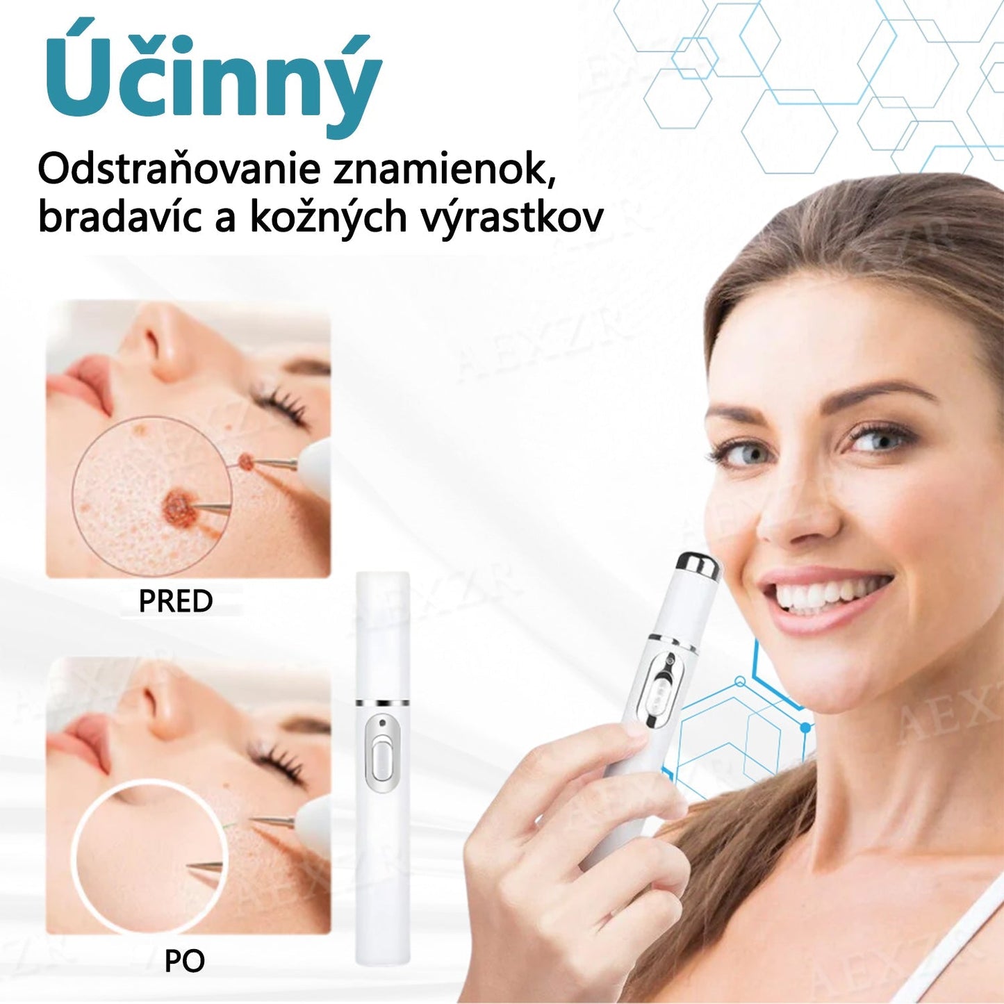 Bikenda® Neinvazívne laserové pero na odstránenie znamienok a bradavíc✨