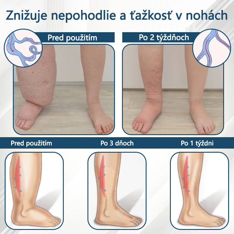 💧💧ATTDX® Bylinný krém na úľavu od opuchov s čiernou rascou💧💧💧💧