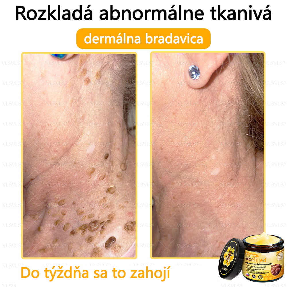 VLSVLS™ Obnovujúci krém na pleť so včelím jedom💥