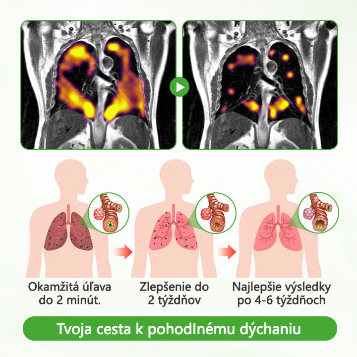 Timilk® Divozel na čistenie pľúc️💠