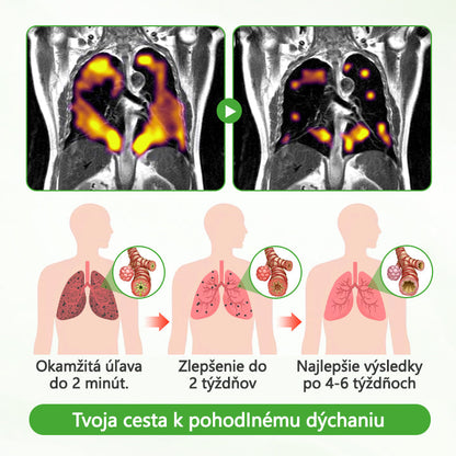 Timilk® Divozel na čistenie pľúc️💠