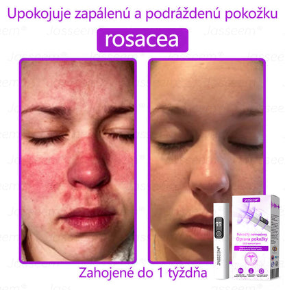 𝐉𝐚𝐬𝐬𝐞𝐞𝐦® Pokročilé neinvazívne CO₂ laserové pero na opravu pokožky 💕 (Jemne odstraňuje bradavice, materské znamienka, starecké škvrny a kožné výrastky – bez bolesti, bez starostí!) 💕