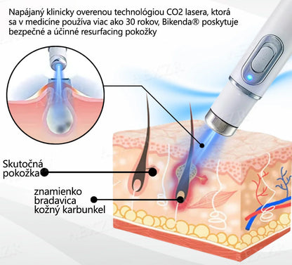 Bikenda® Neinvazívne laserové pero na odstránenie znamienok a bradavíc✨