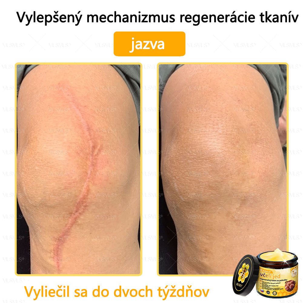 VLSVLS™ Obnovujúci krém na pleť so včelím jedom💥