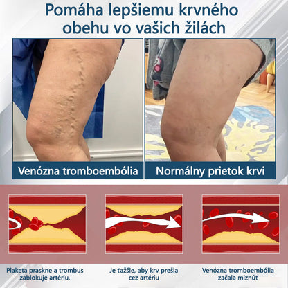 💧💧ATTDX® Bylinný krém na úľavu od opuchov s čiernou rascou💧💧💧💧