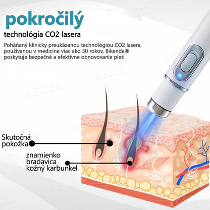 Bikenda® Neinvazívne laserové pero na odstránenie znamienok a bradavíc✨