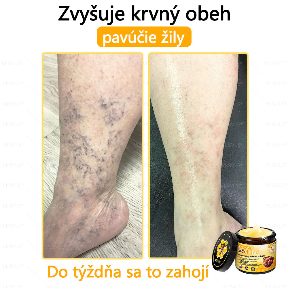 VLSVLS™ Obnovujúci krém na pleť so včelím jedom💥
